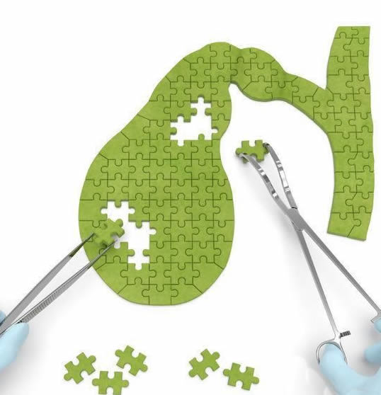 胆囊癌有5个征兆，可惜你一个也不知道!