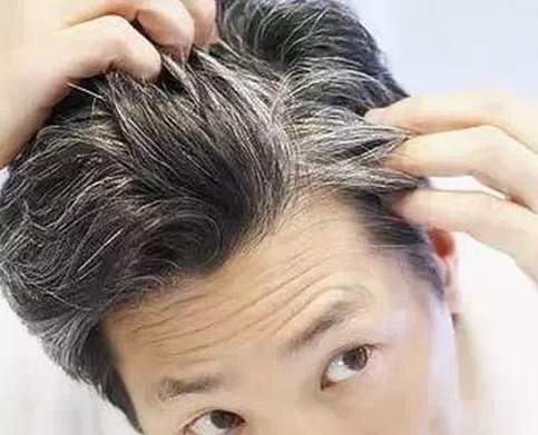 哈佛大学科学家证明白发与压力有关