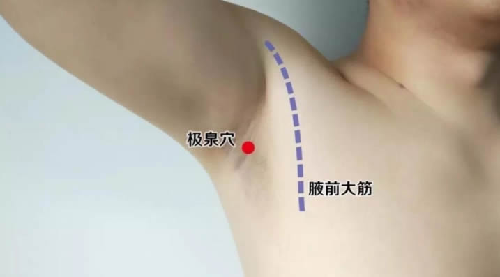 霍云龙黄帝内针急救方法 第 6 张