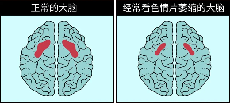 色情片是怎样伤害人体的？ 第 4 张