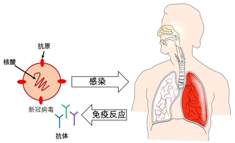 核酸、抗原和抗体，疫情检测三板斧分别做啥用？